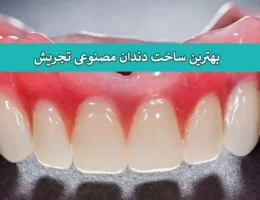 دندان-مصنوعی