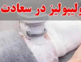 10-کرایولیپولیز-در-سعادت-آباد